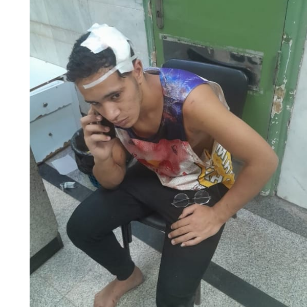 جيمي ال اضرب