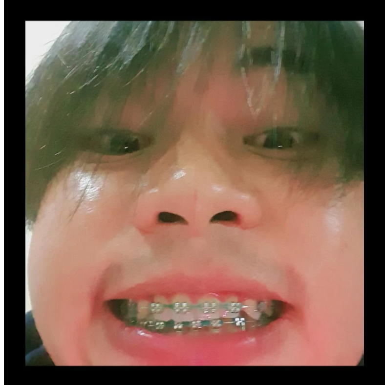 ภูมิพลno.1